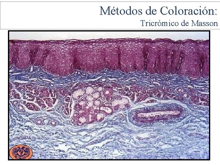 Métodos de Coloración: Tricrómico de Masson 