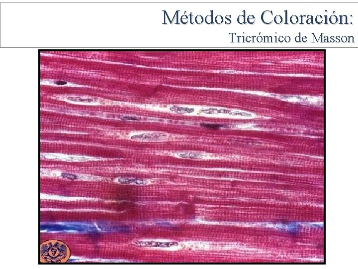 Métodos de Coloración: Tricrómico de Masson 