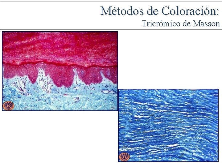 Métodos de Coloración: Tricrómico de Masson 