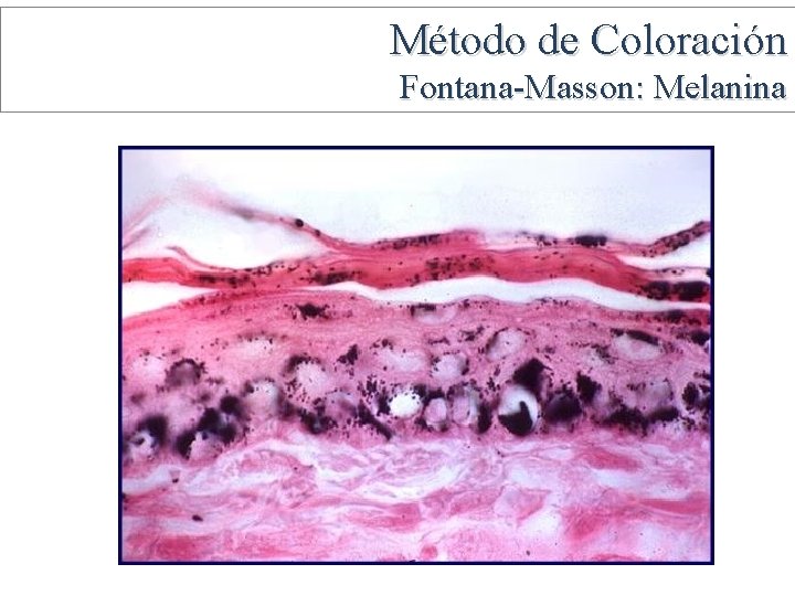 Método de Coloración Fontana-Masson: Melanina 