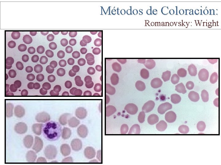 Métodos de Coloración: Romanovsky: Wright 