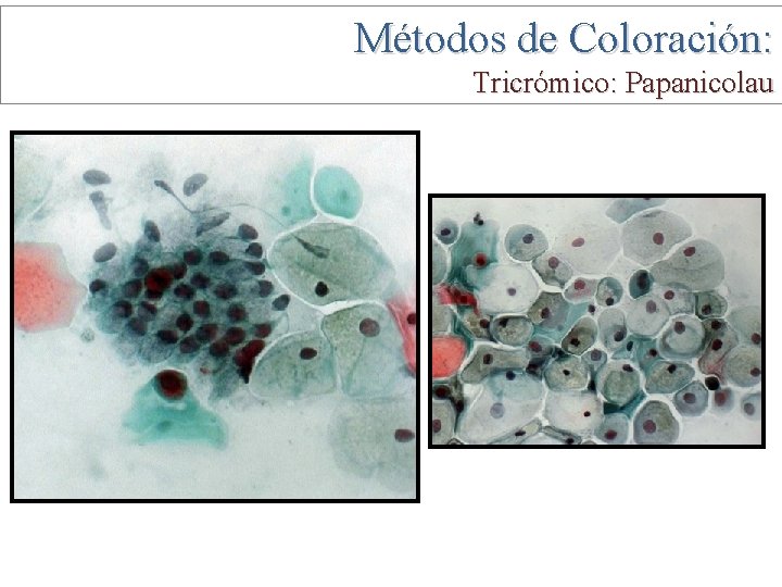 Métodos de Coloración: Tricrómico: Papanicolau 