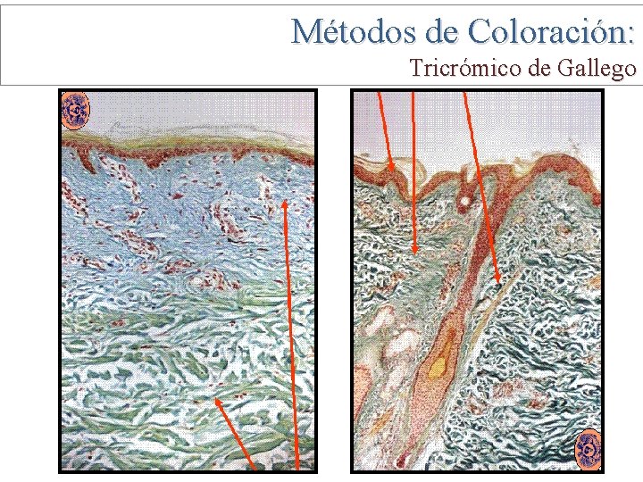 Métodos de Coloración: Tricrómico de Gallego 
