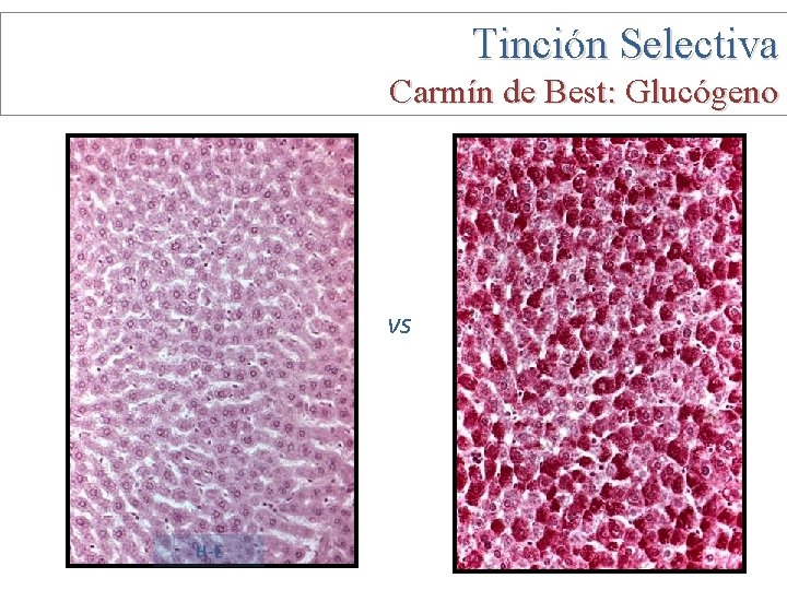 Tinción Selectiva Carmín de Best: Glucógeno vs H-E 