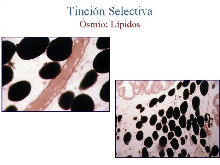 Tinción Selectiva Ósmio: Lípidos 