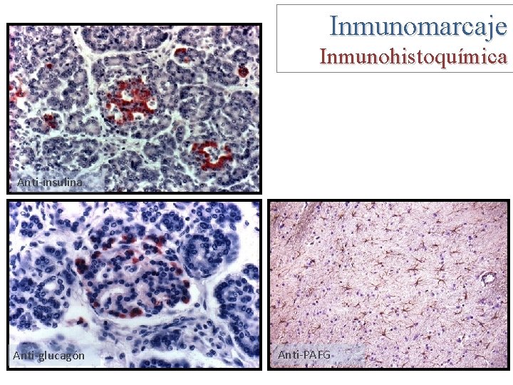 Inmunomarcaje Inmunohistoquímica Anti-insulina Anti-glucagón Anti-PAFG 