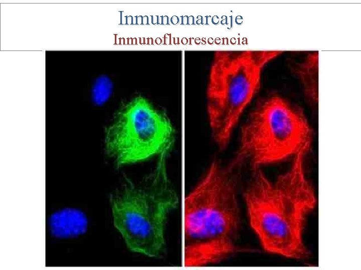 Inmunomarcaje Inmunofluorescencia 