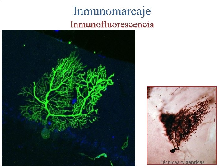 Inmunomarcaje Inmunofluorescencia Técnicas Argénticas 