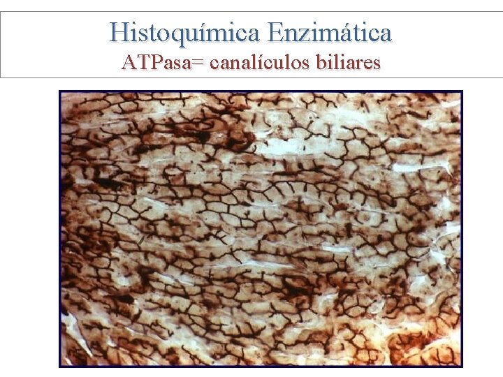 Histoquímica Enzimática ATPasa= canalículos biliares 