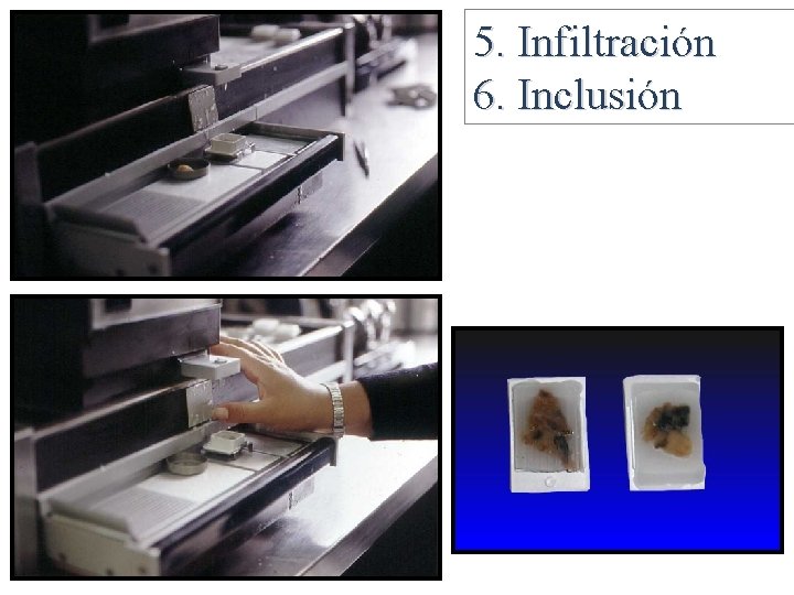 5. Infiltración 6. Inclusión 