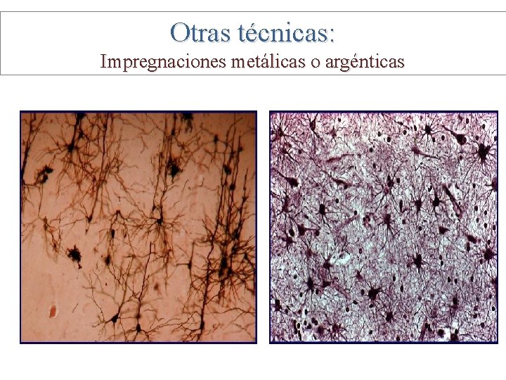 Otras técnicas: Impregnaciones metálicas o argénticas 