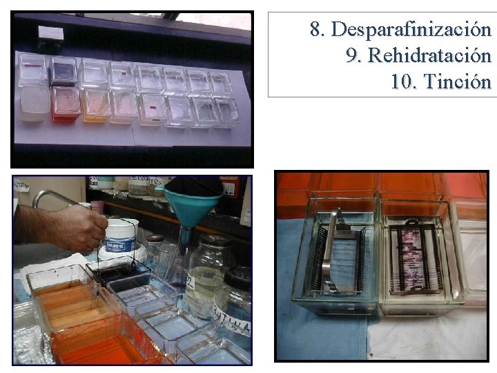 8. Desparafinización 9. Rehidratación 10. Tinción 