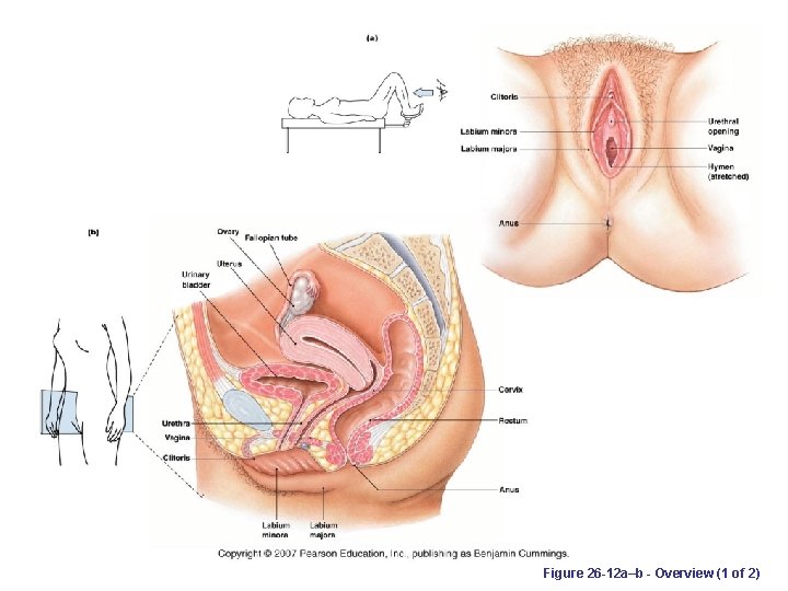 Figure 26 -12 a–b - Overview (1 of 2) 