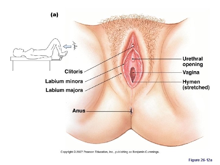 Figure 26 -12 a 