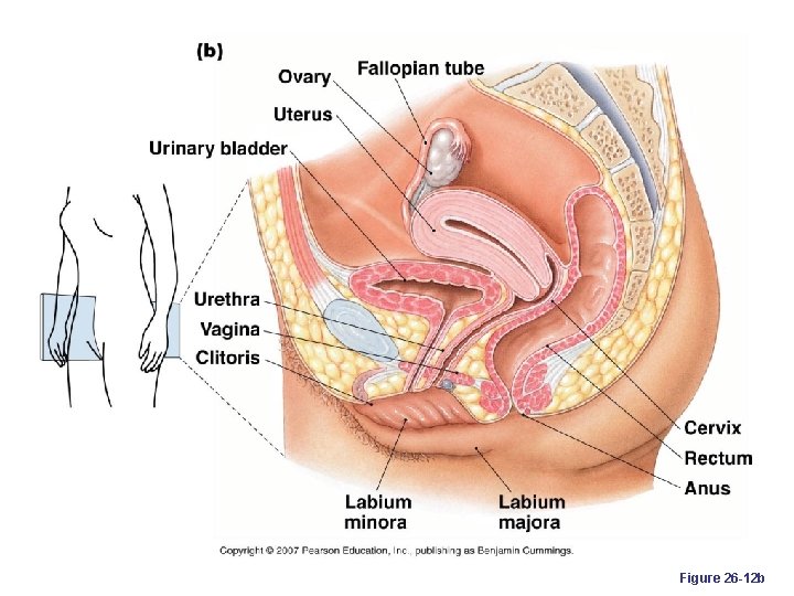 Figure 26 -12 b 