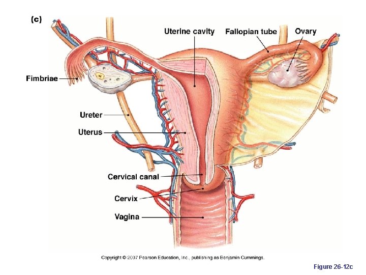 Figure 26 -12 c 