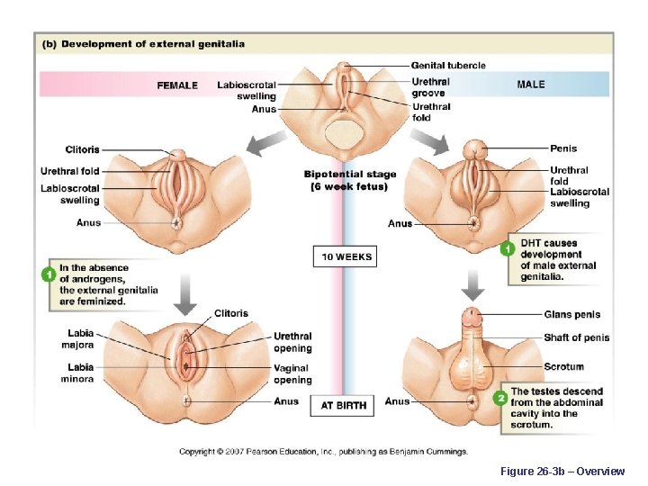 Figure 26 -3 b – Overview 