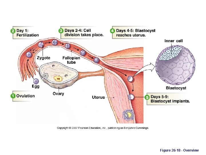 Figure 26 -18 - Overview 