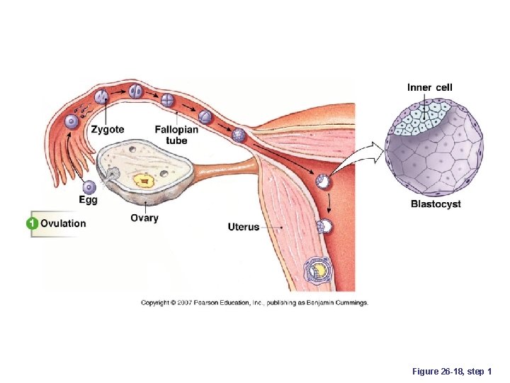 Figure 26 -18, step 1 