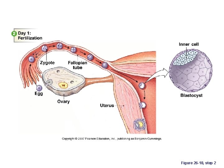 Figure 26 -18, step 2 