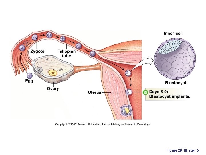 Figure 26 -18, step 5 