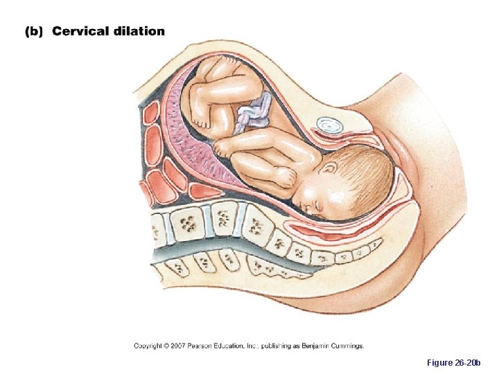 Figure 26 -20 b 