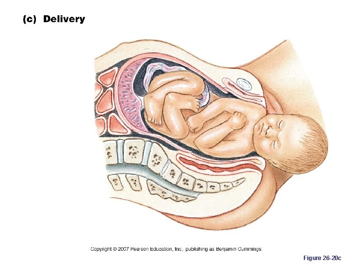 Figure 26 -20 c 