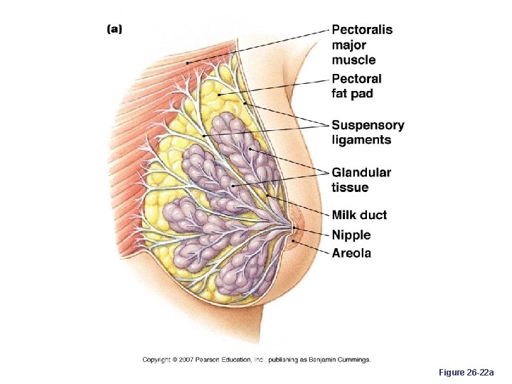 Figure 26 -22 a 