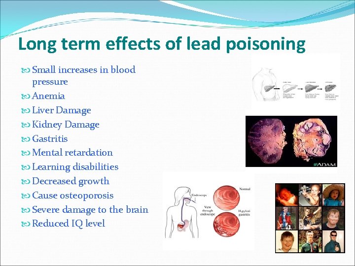 Long term effects of lead poisoning Small increases in blood pressure Anemia Liver Damage Long term effects of lead poisoning Small increases in blood pressure Anemia Liver Damage