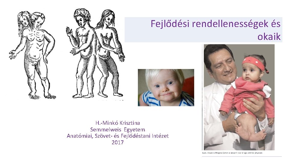 Fejlődési rendellenességek és okaik H. -Minkó Krisztina Semmelweis Egyetem Anatómiai, Szövet- és Fejlődéstani Intézet Fejlődési rendellenességek és okaik H. -Minkó Krisztina Semmelweis Egyetem Anatómiai, Szövet- és Fejlődéstani Intézet