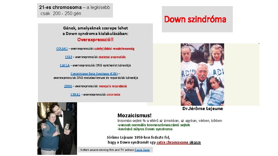 21 -es chromosoma – a legkisebb csak 200 - 250 gén Down szindróma Gének, 21 -es chromosoma – a legkisebb csak 200 - 250 gén Down szindróma Gének,