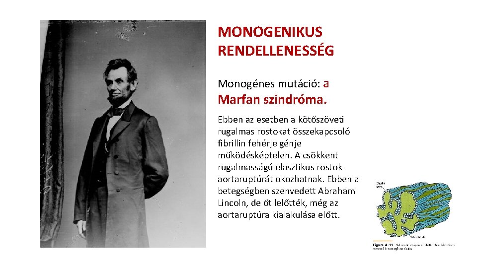 MONOGENIKUS RENDELLENESSÉG Monogénes mutáció: a Marfan szindróma. Ebben az esetben a kötőszöveti rugalmas rostokat