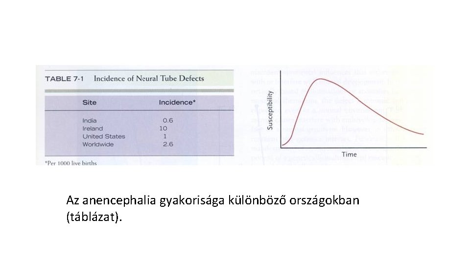 Az anencephalia gyakorisága különböző országokban (táblázat). 