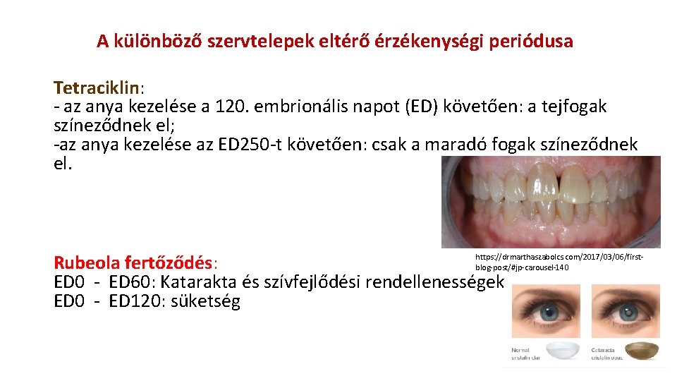 A különböző szervtelepek eltérő érzékenységi periódusa Tetraciklin: - az anya kezelése a 120. embrionális A különböző szervtelepek eltérő érzékenységi periódusa Tetraciklin: - az anya kezelése a 120. embrionális