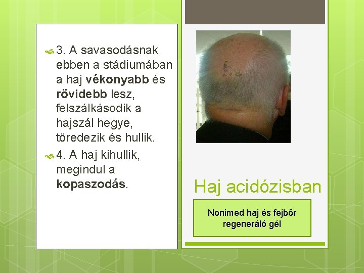  3. A savasodásnak ebben a stádiumában a haj vékonyabb és rövidebb lesz, felszálkásodik