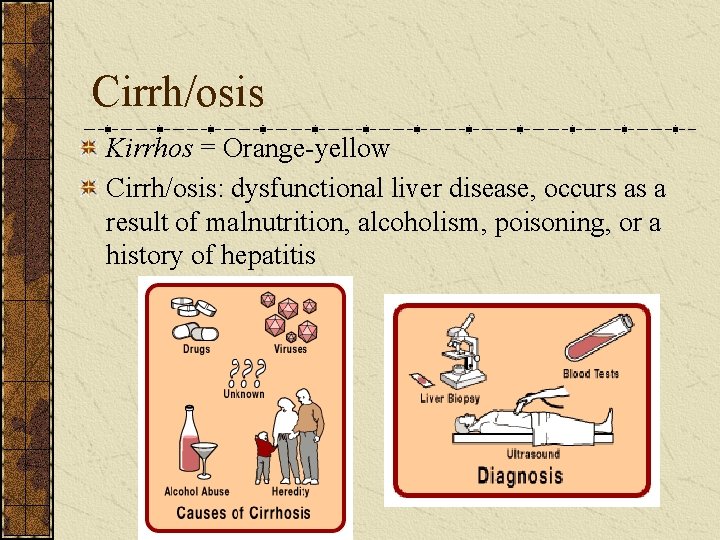 Cirrh/osis Kirrhos = Orange-yellow Cirrh/osis: dysfunctional liver disease, occurs as a result of malnutrition,