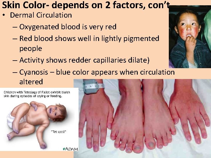 Skin Color- depends on 2 factors, con’t • Dermal Circulation – Oxygenated blood is