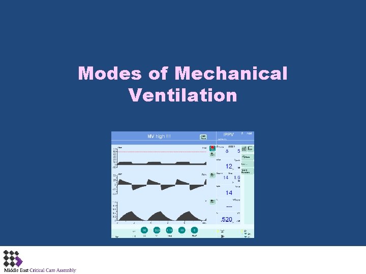 Modes of Mechanical Ventilation 