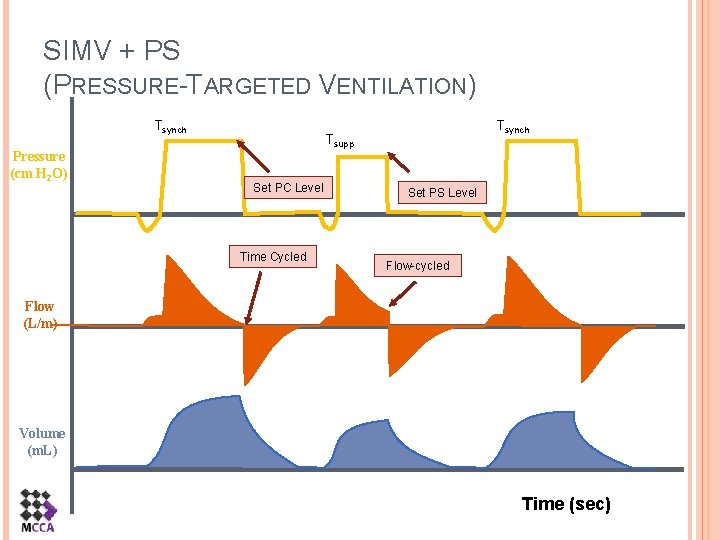 SIMV + PS (PRESSURE-TARGETED VENTILATION) Tsynch Pressure (cm H 2 O) Tsynch Tsupp Set