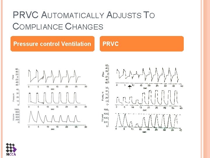 PRVC AUTOMATICALLY ADJUSTS TO COMPLIANCE CHANGES Pressure control Ventilation PRVC 