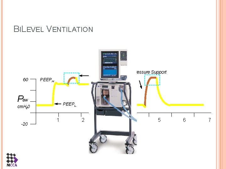 BILEVEL VENTILATION 60 PEEPHigh + PS PEEPH Paw PEEPL cm. H 20 -20 Pressure