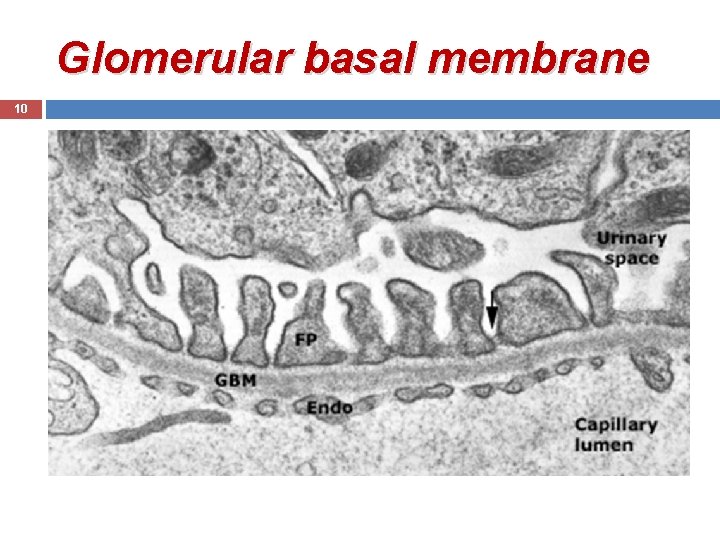 Glomerular basal membrane 10 