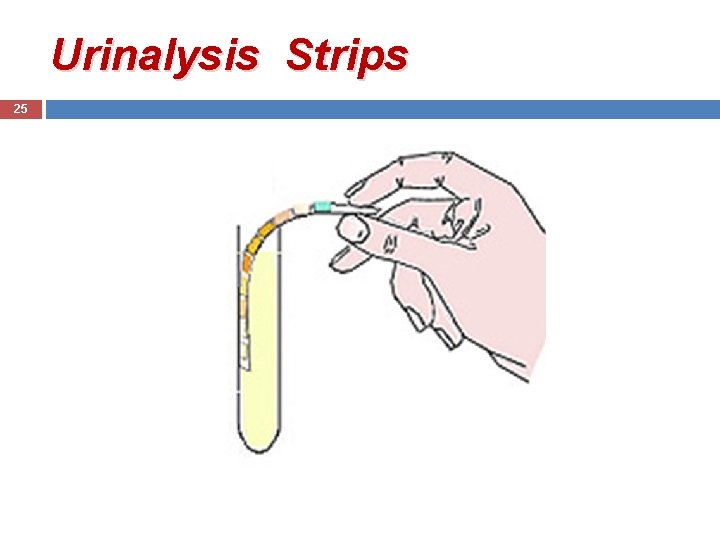 Urinalysis Strips 25 