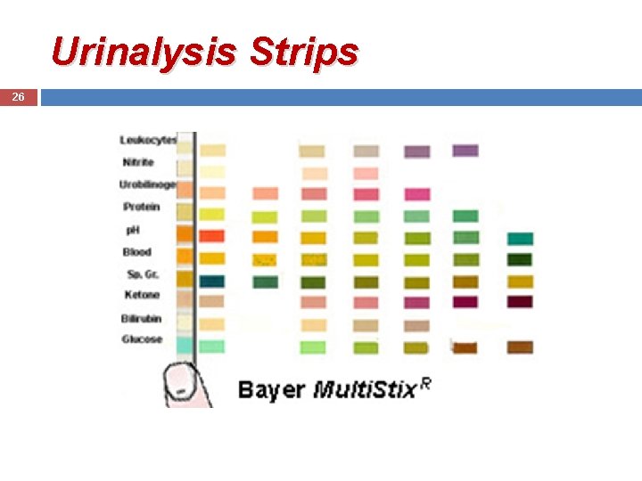 Urinalysis Strips 26 