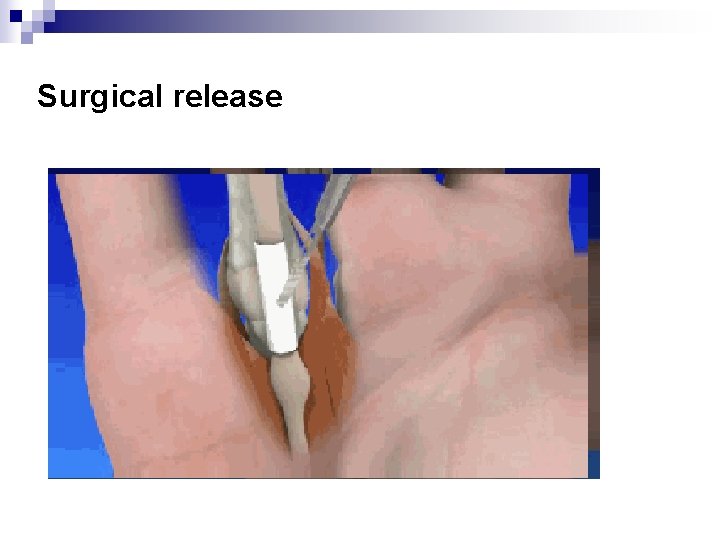 Surgical release 