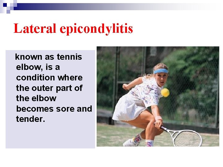 Lateral epicondylitis known as tennis elbow, is a condition where the outer part of