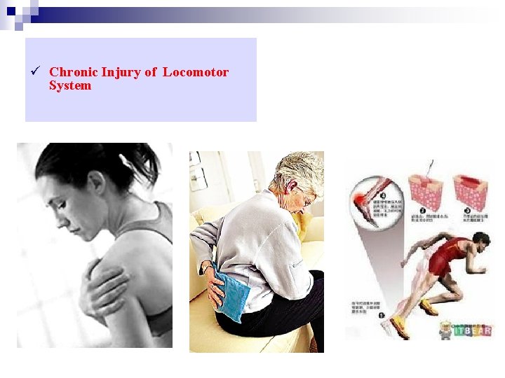 ü Chronic Injury of Locomotor System 