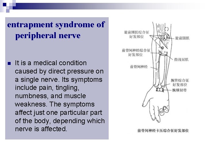 entrapment syndrome of peripheral nerve n It is a medical condition caused by direct