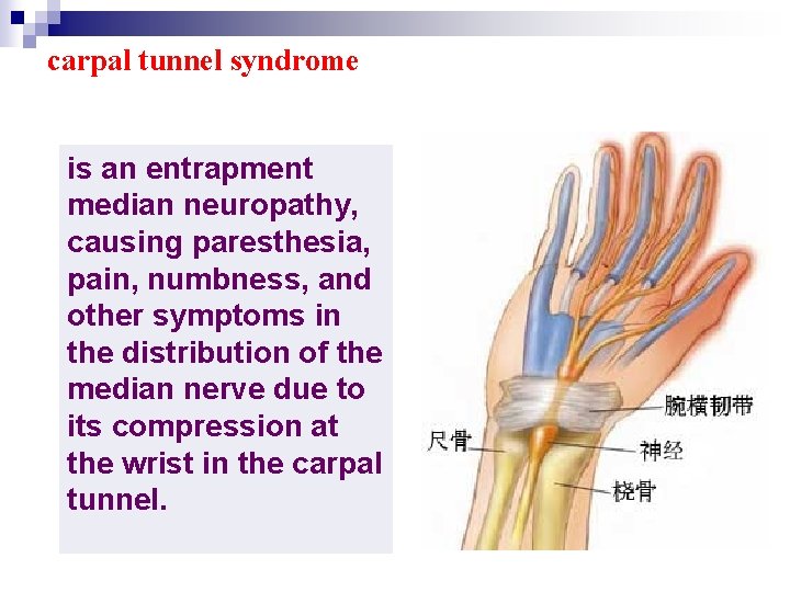 carpal tunnel syndrome is an entrapment median neuropathy, causing paresthesia, pain, numbness, and other