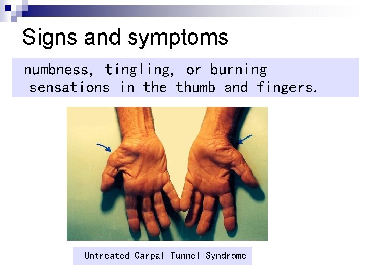 Signs and symptoms numbness, tingling, or burning sensations in the thumb and fingers. Untreated